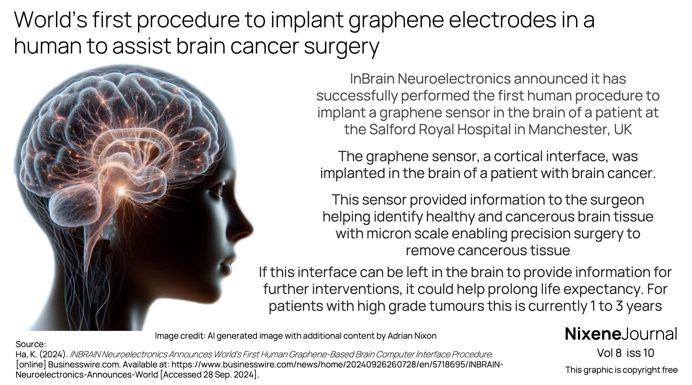 v8 i10 World’s first procedure to implant graphene electrodes in a human to assist brain cancer surgery